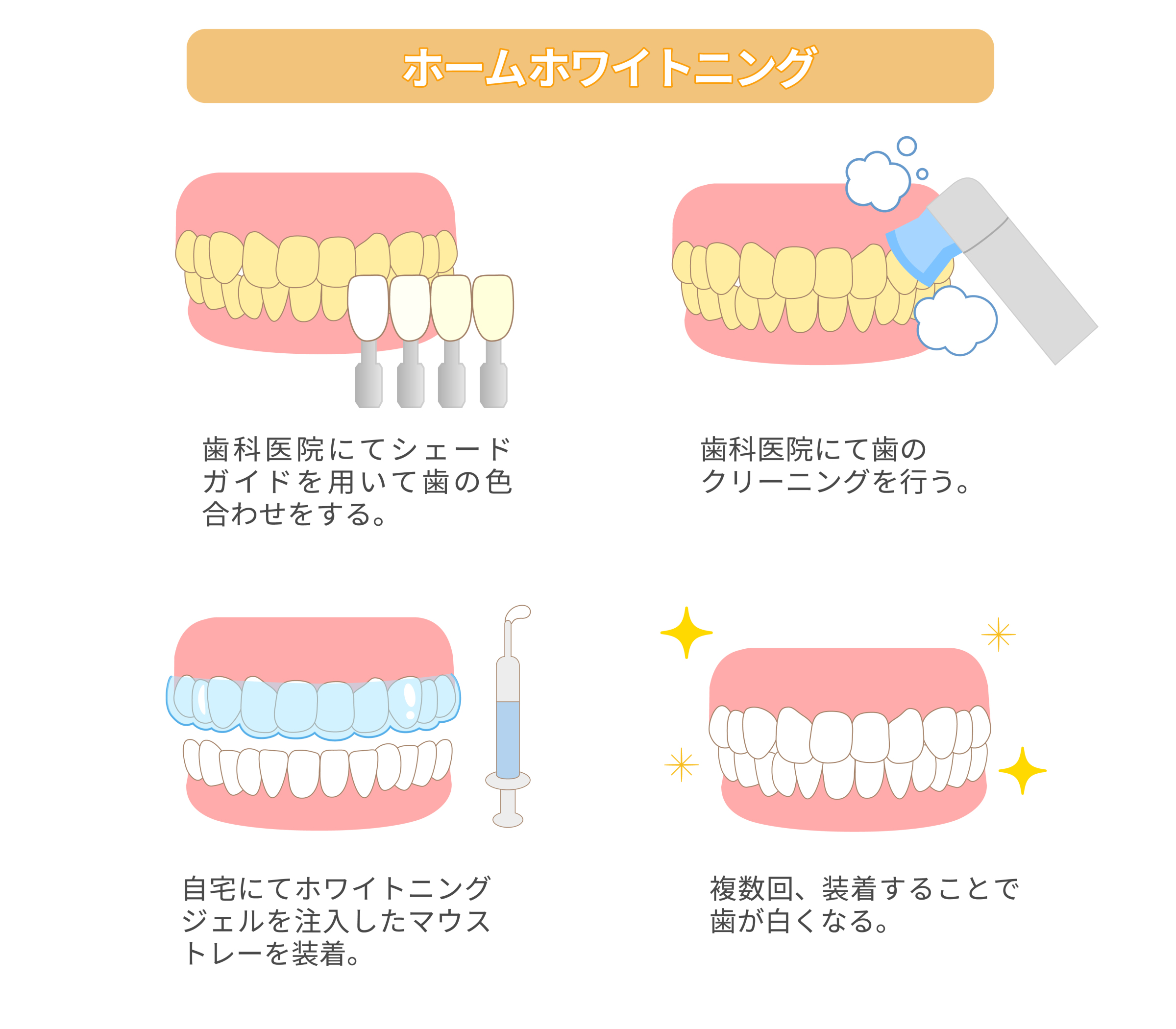home-whitening